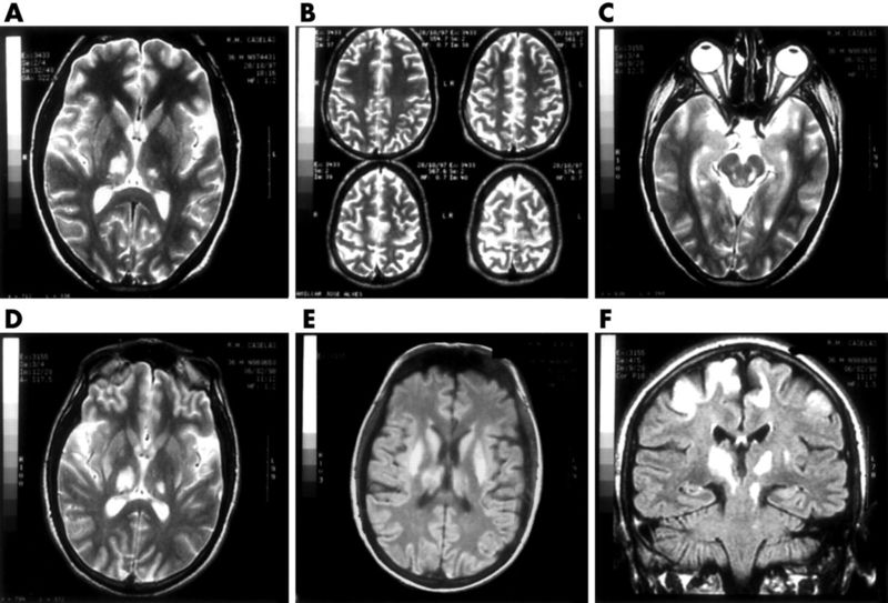 ചിത്രം:Vol5p218 MRI Scanning result.jpg