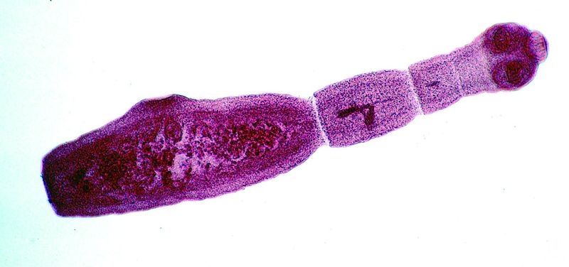 ചിത്രം:Vol5p17 Echinococcus-multilocularis-adult.jpg