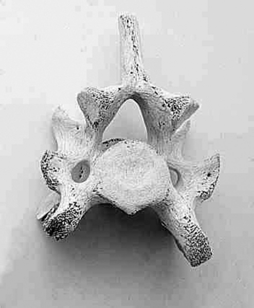 ചിത്രം:Vertebra.png