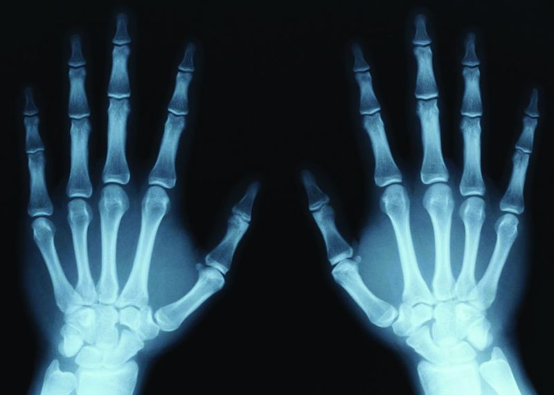 ചിത്രം:Vol5p17 images xray-human.jpg